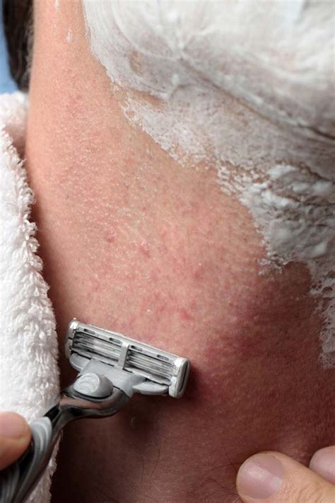 razor: Get Latest Buzz, Updates, Gossip, Photos & Videos