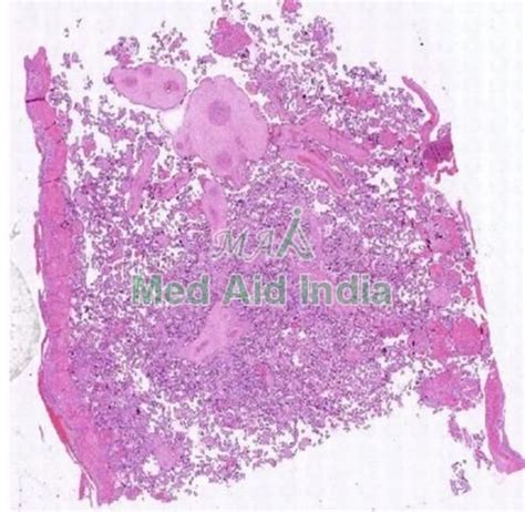 Placenta Prepared Microscope Slide Manufacturer, Supplier from Noida