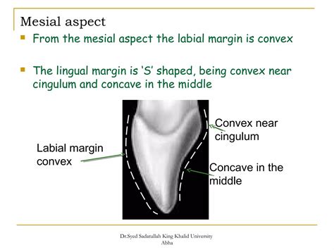 morphology of Maxillary central and lateral incisors teeth | PPT