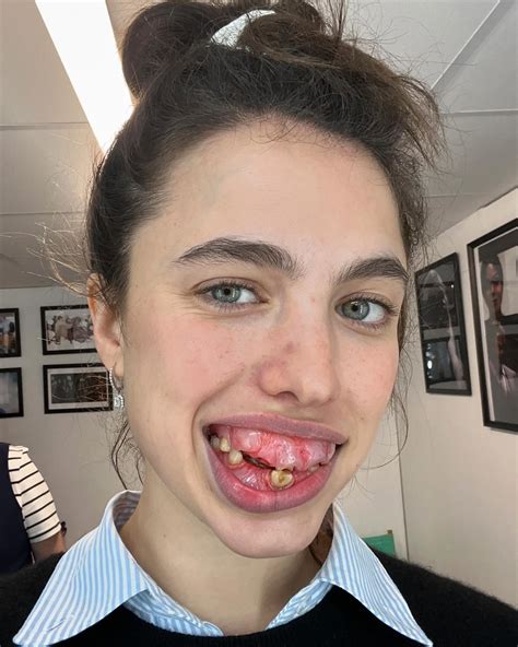 Margaret Qualley says ‘The Substance’ prosthetics gave her acne for a year
