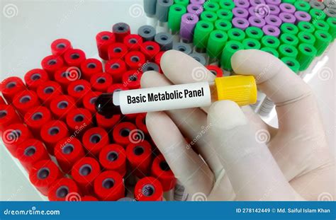 Basic metabolic panel test stock image. Image of tube - 278142449