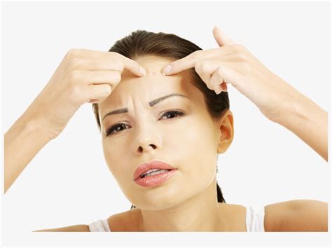 Image result for Extreme Zit Exploding