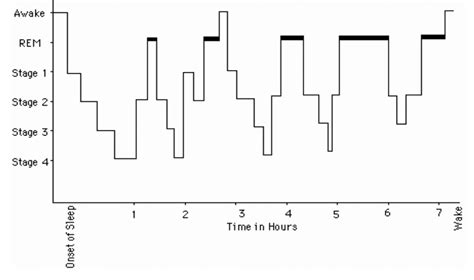 Narcolepsy Sleep Cycle Graph 的图像结果