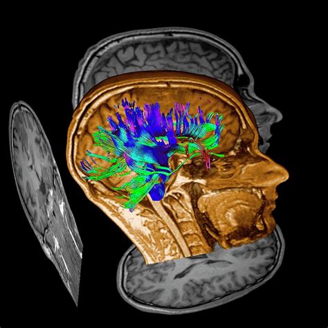 Image result for fMRI Python