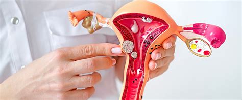 Uterus-Preserving Laparoscopic Myomectomy at Sangolkar Hospital, Sangli
