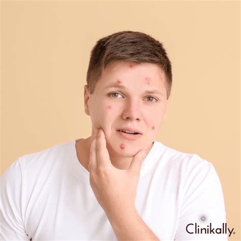 Topical Retinol: Benefits, and How to Use | Clinikally