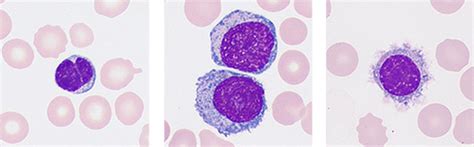 MC-80 Automated Digital Cell Morphology Analyzer | | 5-Diff Hematology ...