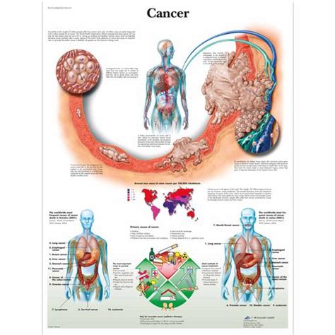 Anatomical Charts and Posters - Anatomy Charts - Pathology Charts ...