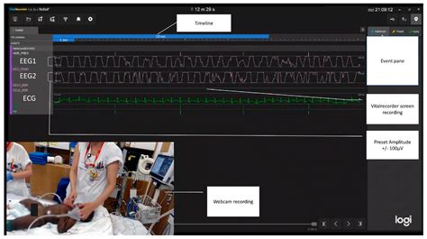 Integrating Neuromonitoring in Pediatric Emergency Medicine: Exploring ...