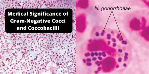 Gram Neg Diplococci