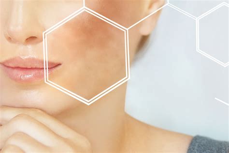 The Importance of Ingredients in Products for Skin Hyperpigmentation ...