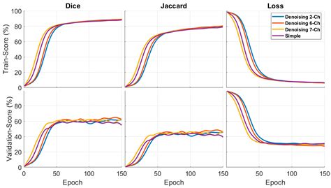 Dual-Tree Complex Wavelet Input Transform for Cyst Segmentation in OCT ...