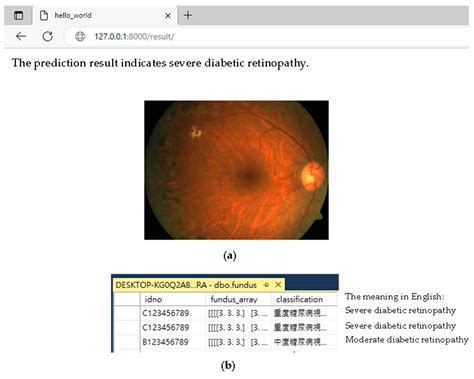 Enhancing Diabetic Retinopathy Detection Using Pixel Color ...