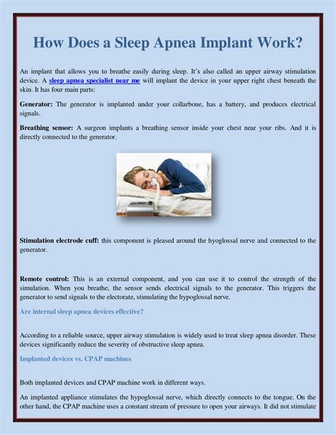 PPT - How Does a Sleep Apnea Implant Work? PowerPoint Presentation, free download - ID:11673421