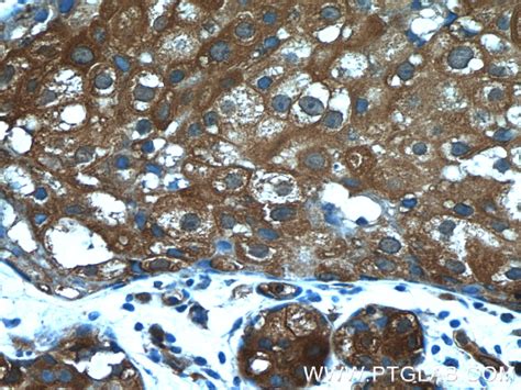 PKLR antibody (22456-1-AP) | Proteintech