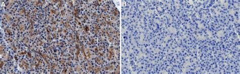 Anti-GLUT-1 Antibody, CT | 07-1401