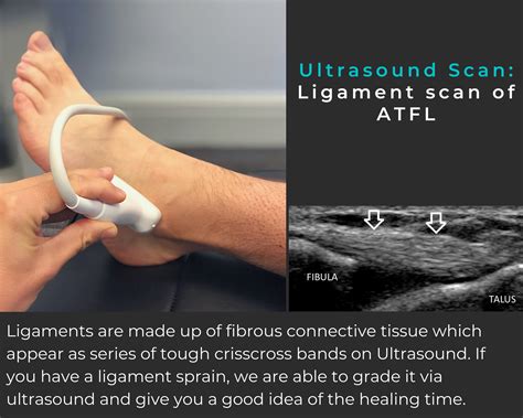 Ultrasound Scan — LB Physio