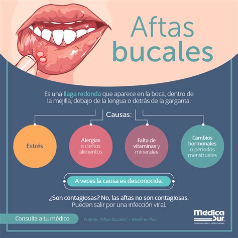 Best 13 Como Diferencias los Fuegos Labiales o Aftas de un Herpes ...
