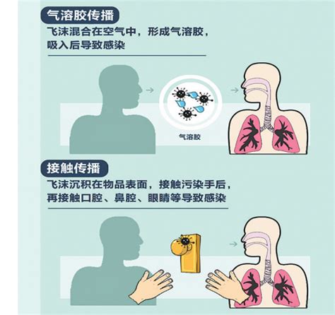 新型冠状病毒肺炎肺部CT表现的5个特点_济南齐鲁花园医院