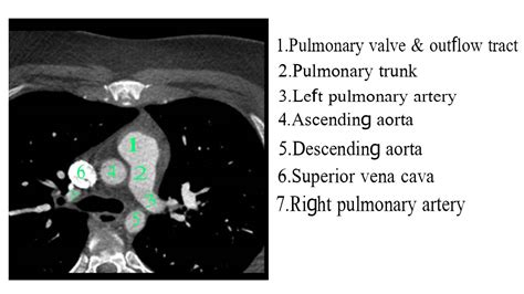 CT Scan 的图像结果