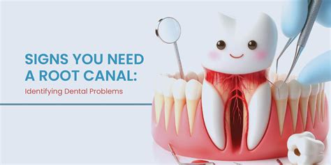 Signs You Need a Root Canal Treatment: Identifying Dental Problem