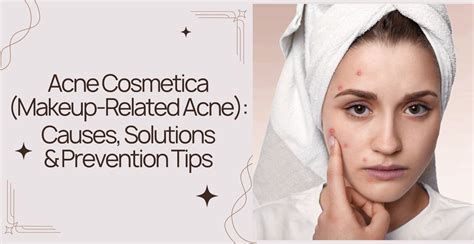 Could Your Cosmetics Be the Cause of Your Acne?