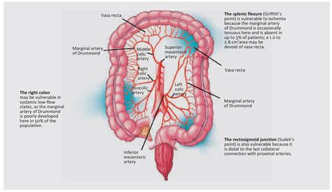 Colon Ischaemia: Risk Factors, Diagnosis & Management - Walter Bushnell ...