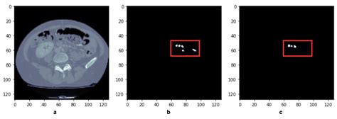 Mixed-Sized Biomedical Image Segmentation Based on U-Net Architectures