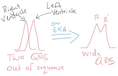 How To Bundle Branches With String at Nicholas Packard blog