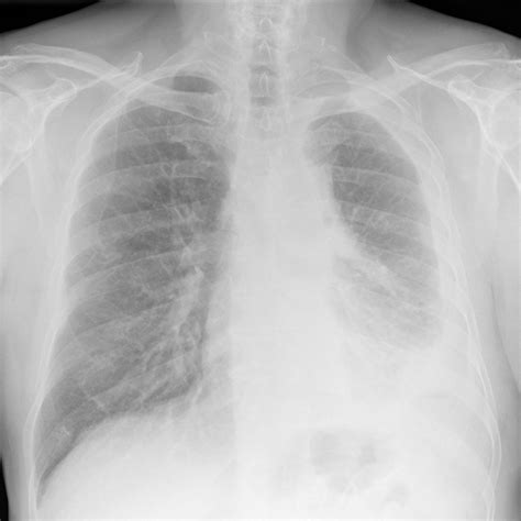 Prise en charge chirurgicale – mise à jour - Médecine interne ...