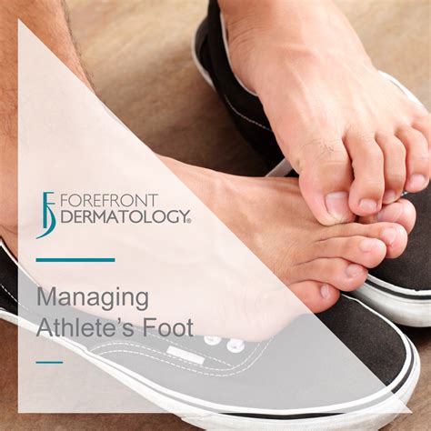 Can Athlete S Foot Spread To Your Hands at Charlie Skirving blog