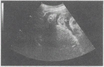 孕35周超声检查，下图中箭头所指是胎儿颜面的哪一部位：