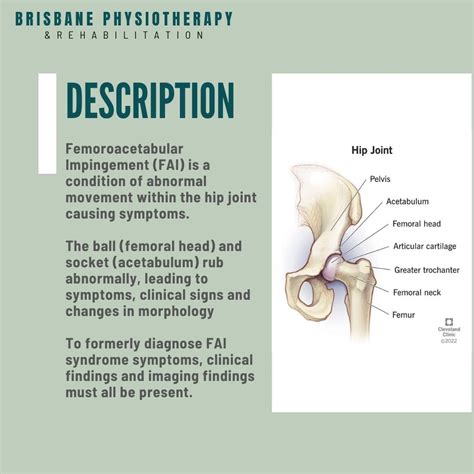 FAI Syndrome - FAI Hip Impingement Syndrome - Symptoms, Diagnosis & Treatment - Brisbane ...