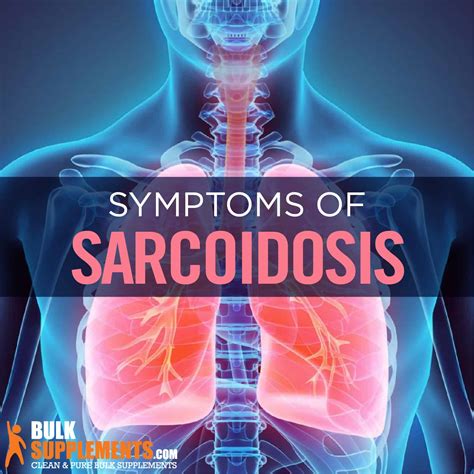 Sarcoidosis: Symptoms, Causes & Treatments