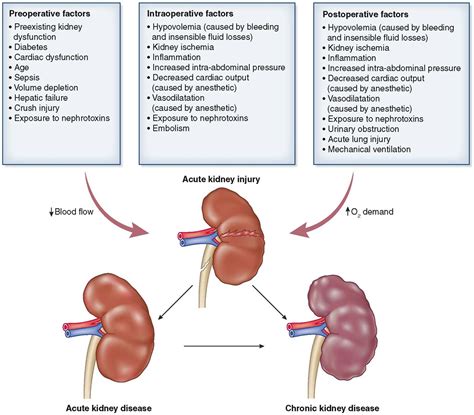 Postoperative Acute Kidney Injury : Clinical Journal of the American ...