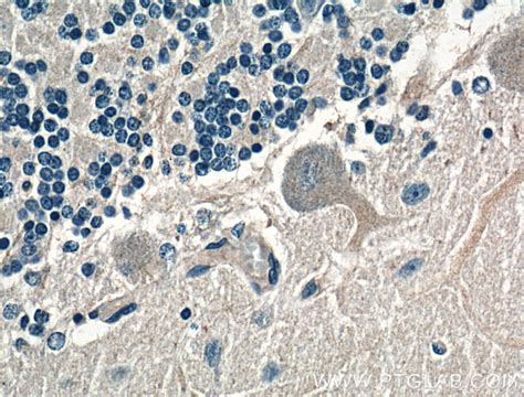 AMPD2 antibody (15710-1-AP) | Proteintech