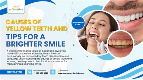 Causes of Yellow Teeth and Tips for a Brighter Smile