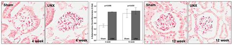 Transcription Factor β-Catenin Plays a Key Role in Fluid Flow Shear ...