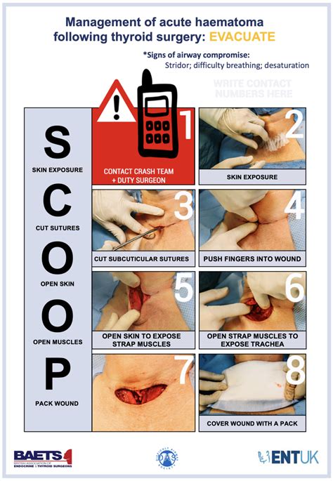 Guidelines Archives - Difficult Airway Society
