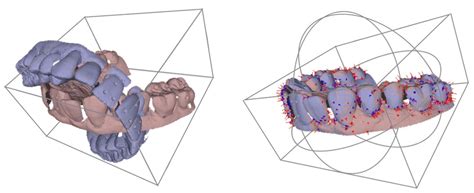 Accuracy of 3D Tooth Movements in the Fabrication of Manual Setup ...
