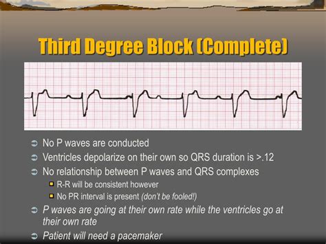 Image result for ACLS Code Blue Algorithm