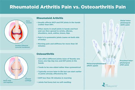 Rheumatoid Arthritis vs. Osteoarthritis: What’s the Difference?
