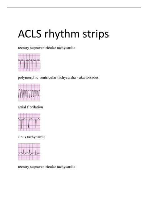 ACLS rhythm strips - ACLS - Stuvia US
