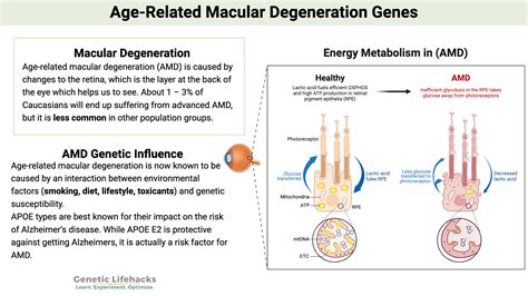 Is Macular Degeneration Hereditary