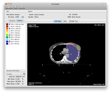 Image result for wxPython Image Viewer
