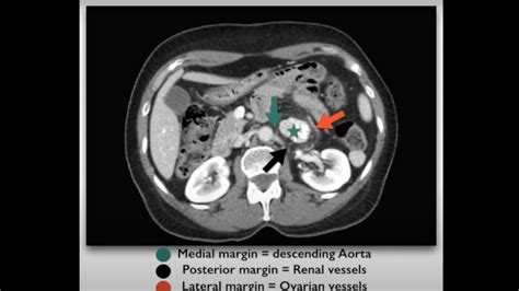 Kuvatulokset haulle castleman s disease specialist