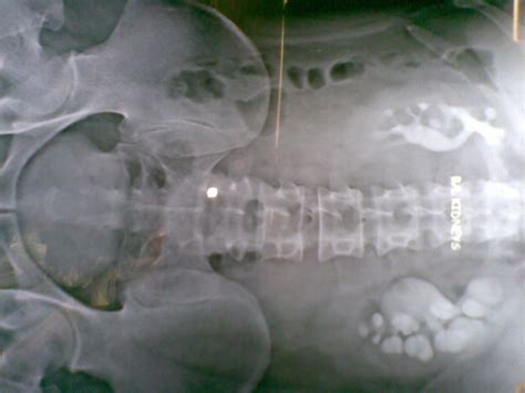 Photo Gallery – Surgeries and procedures