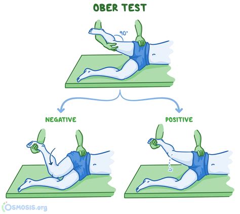 Special tests for the lower limb | Osmosis