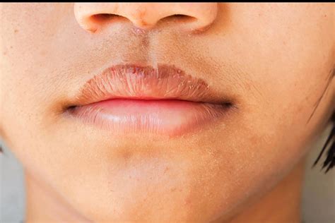 Causes of Dryness in Women Over 50 & What You Can Do