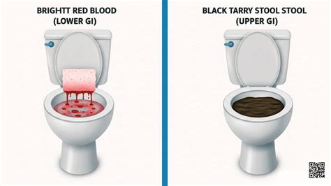 Blood in Stool: When to Worry, Causes, and Meaning - Dr Gina Sam MD